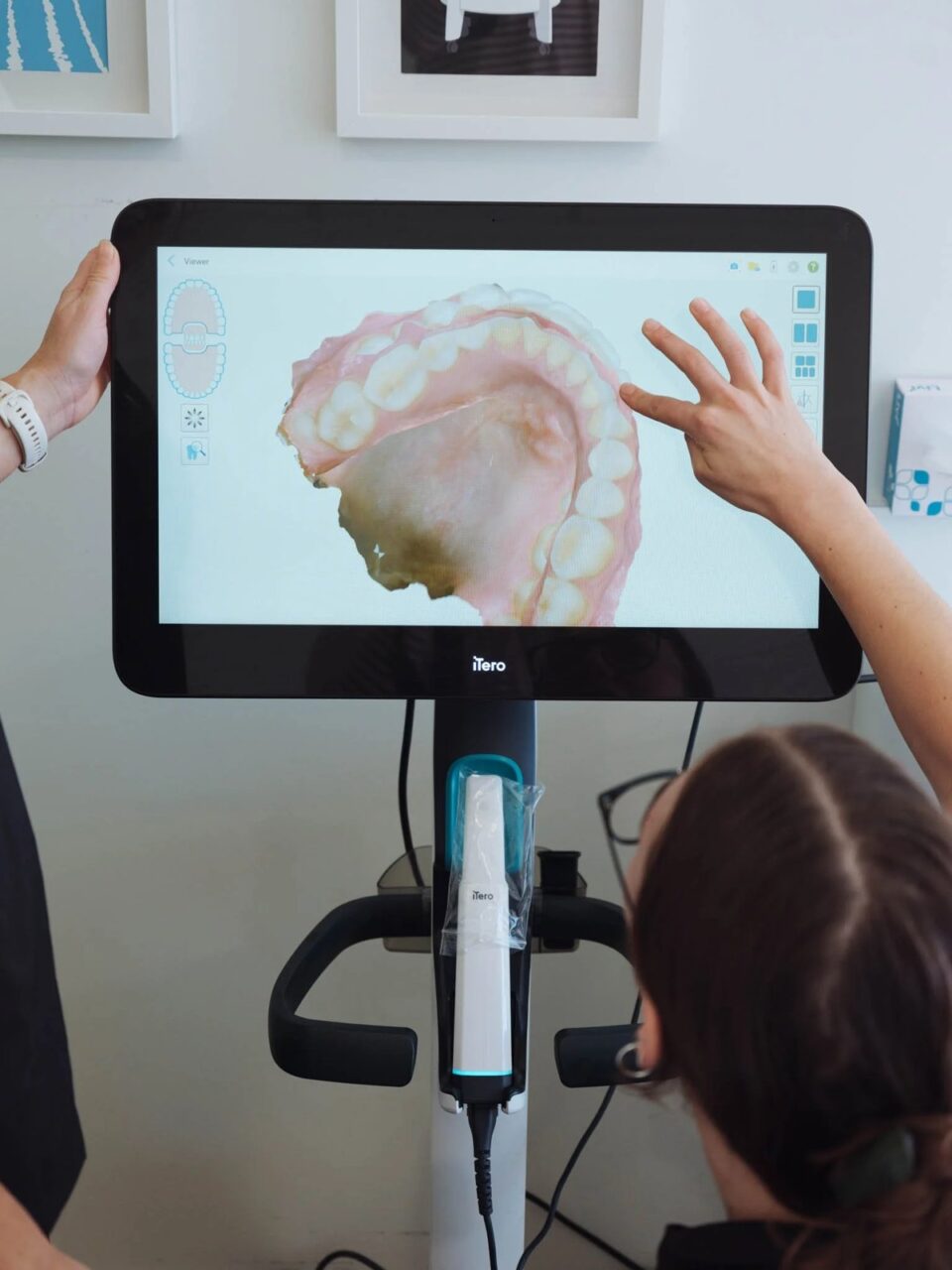 Staff reviewing an iTero 3D scan at Quin Dental